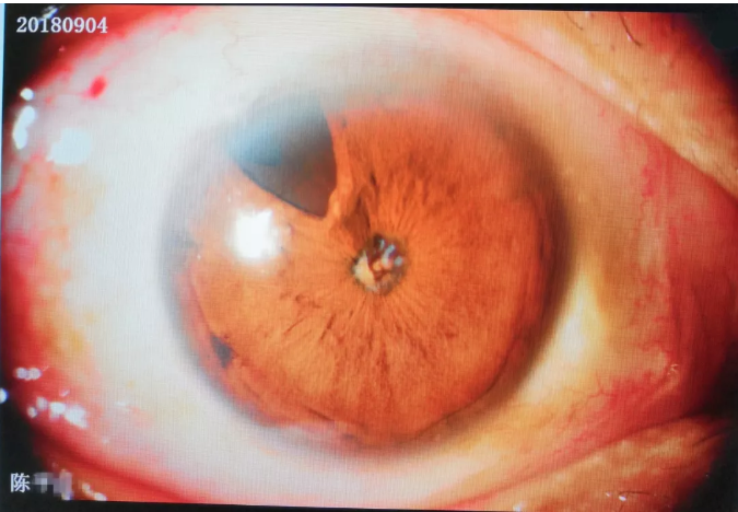 QQ截图20181013095706.png QQ截图20181013095706.png