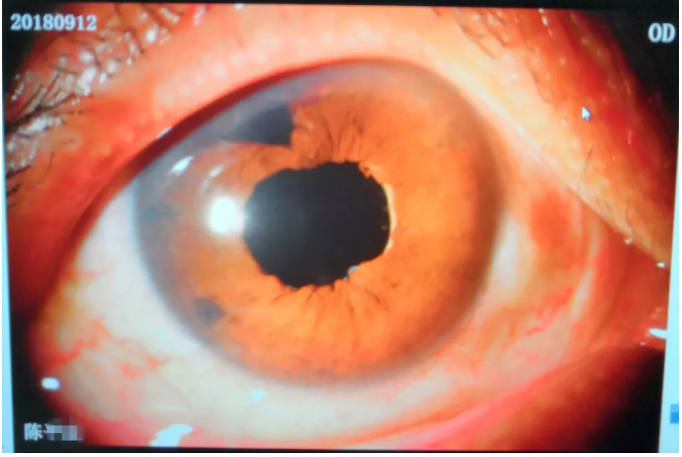 QQ截图20181013095714.png QQ截图20181013095714.png