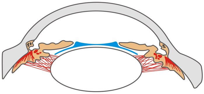 2-14022FZ109413.jpg 2-14022FZ109413.jpg